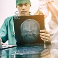 Baltimore Car Accident Lawyers discuss Brain Injury Awareness Month. 